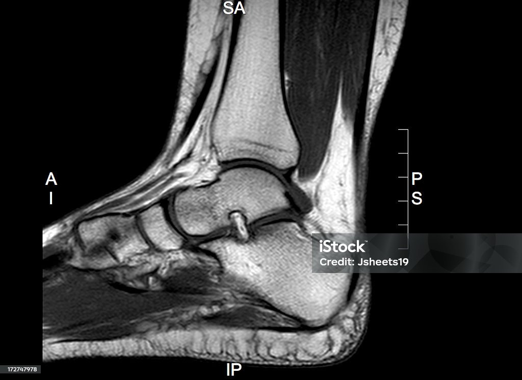 足首の MRI - MRI検査のロイヤリティフリーストックフォト