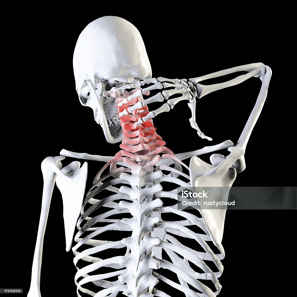 Dor no Pescoço ilustração - Foto de stock de Anatomia royalty-free