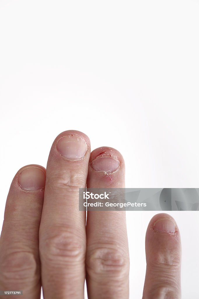 指を噛む - 噛むのロイヤリティフリーストックフォト