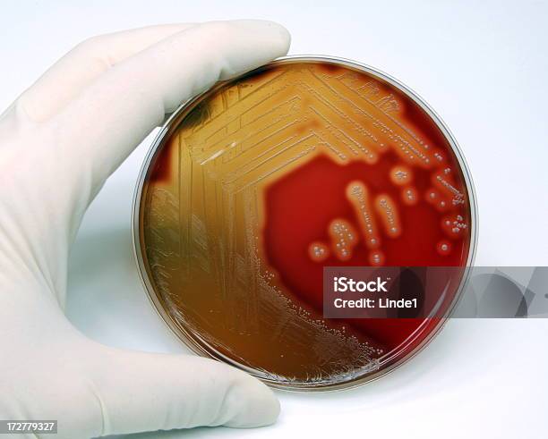 Гемолитическая Streptococci — стоковые фотографии и другие картинки Анализировать - Анализировать, Антибиотик, Бактерия