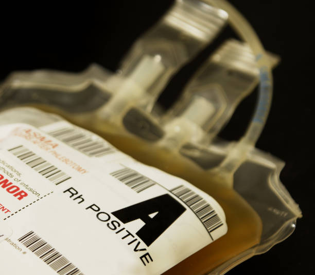 istock Pint of A positive fresh frozen plasma 172782113