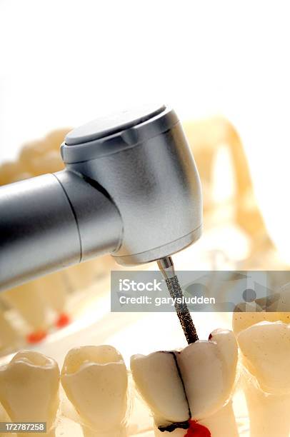 Extracção De Dente - Fotografias de stock e mais imagens de Bardana-menor - Bardana-menor, Beleza, Branco