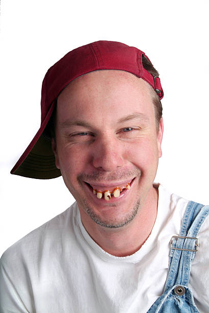istock Man with Dumb Expression and Bad Teeth in Overalls 172792815