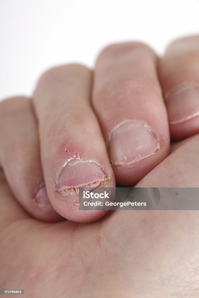 Roer as unhas das mãos - Foto de stock de Ansiedade royalty-free