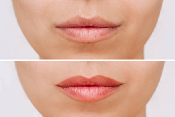 istock Young woman's face with lips before and after permanent makeup. Lip tattooing. Using of a lip pencil 1728123922
