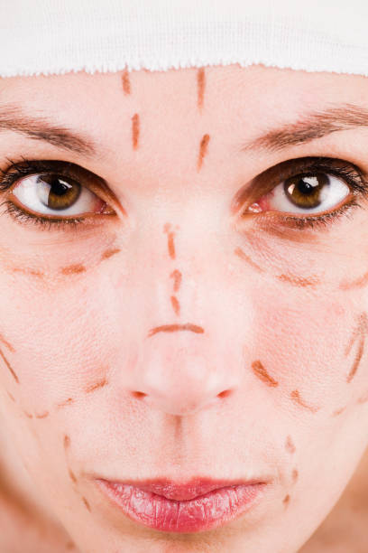 istock Face lift closeup 172856634