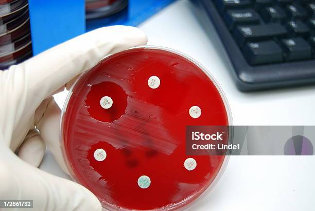 Antibiótico Las Pruebas De Sensibilidad En Un Laboratorio De Microbiología Foto de stock y más banco de imágenes de Placa de Petri