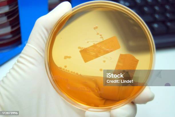 Salmonella Foto de stock y más banco de imágenes de Analizar - Analizar, Antibiótico, Antihigiénico