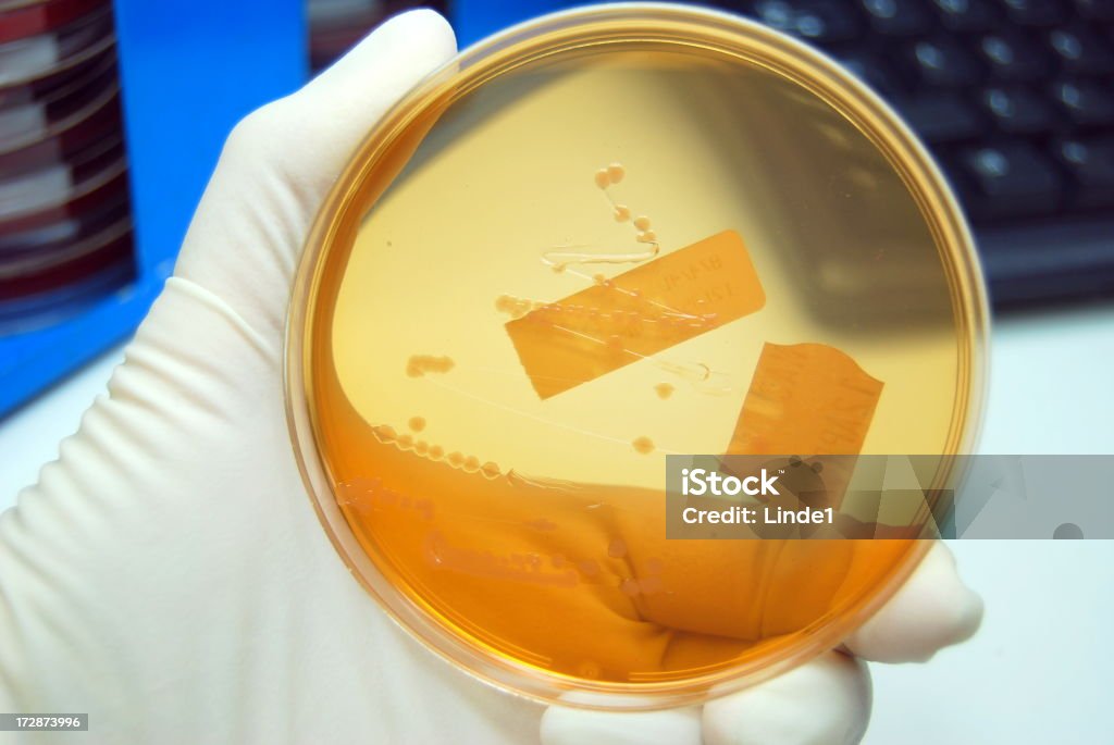 Salmonella - Photo de Agent pathogène libre de droits