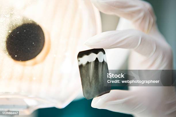 Imagem De Raios X Dental - Fotografias de stock e mais imagens de Adulto - Adulto, Analisar, Consultório Dentário