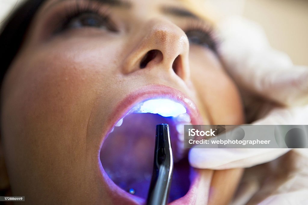 At 치과 - 로열티 프리 의료용 레이저 스톡 사진