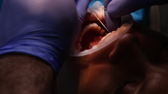 Dental hygienist brushes patient teeth