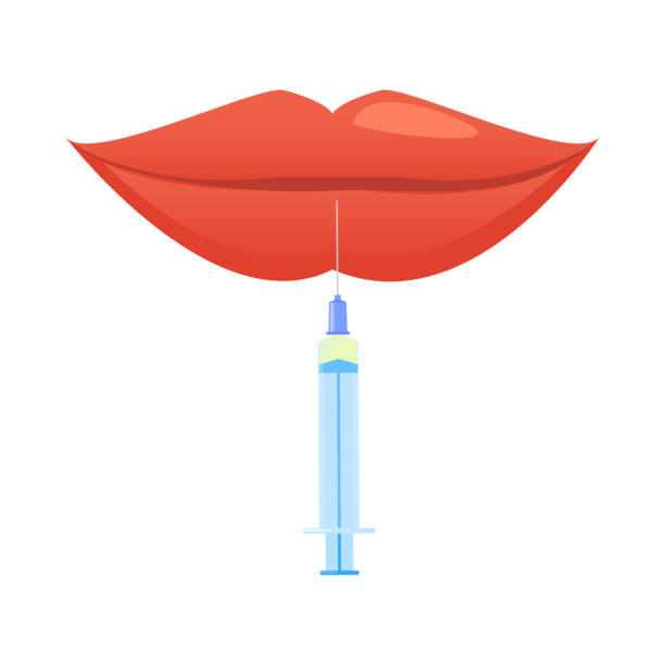 ilustrações de stock, clip art, desenhos animados e ícones de lip plumping augmentation with filler injection illustration - fish lips illustrations