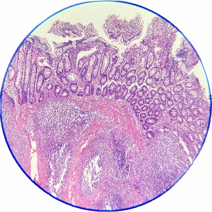 Ileum sec, showing goblet cells and intestinal glands, stained by hematoxylin-eosin, 100x.