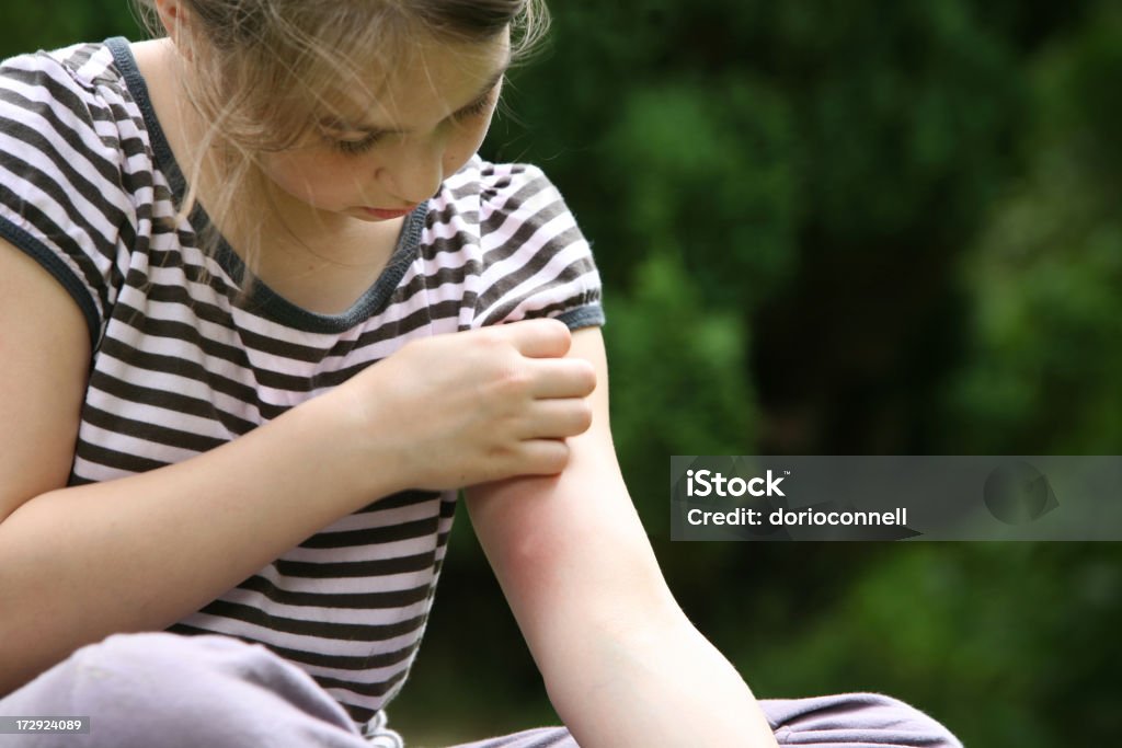 big mosquito bite girl with mosquito bite, scratching hand has motion blur, Mosquito Stock Photo