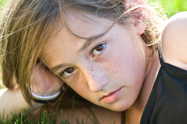 White female suffering from hyperpigmentation (melasma) is looking at camera.