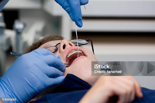 Boy Getting Braces Adjusted Stock Photo - Download Image Now - Boys, Dental Braces, Orthodontist