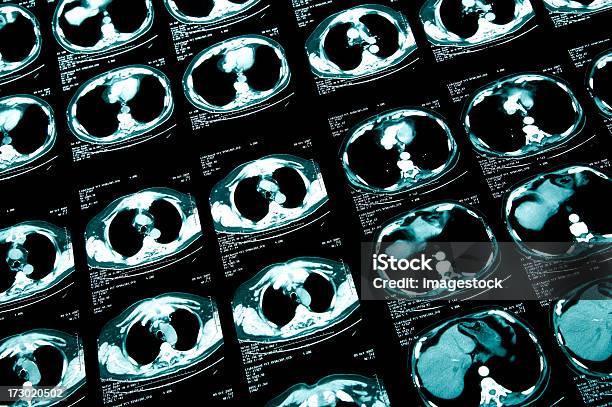 Cat Scan Stockfoto und mehr Bilder von Analysieren - Analysieren, Anatomie, Blau