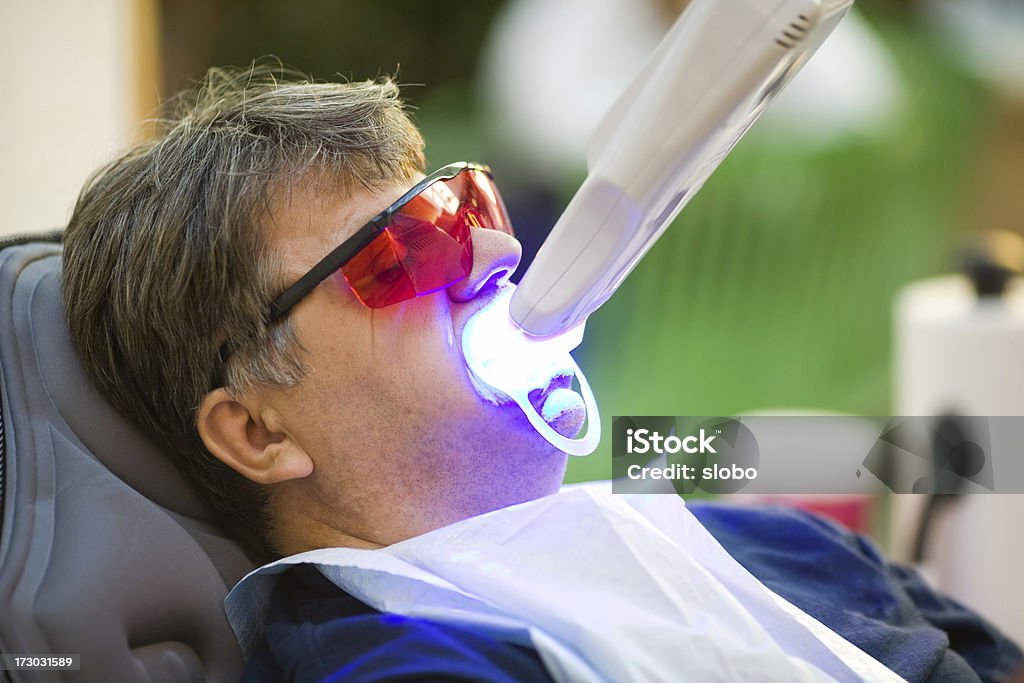 UV blanqueamiento dental - Foto de stock de Adulto libre de derechos