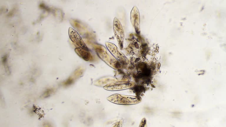 Groupe of Paramecium Caudatum - Stock video