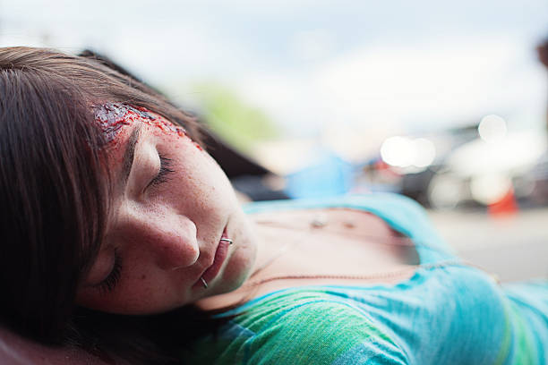 istock Injured teenager 173069425
