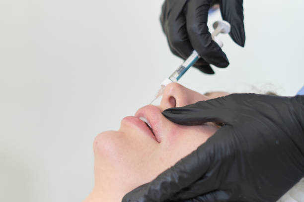 istock Lip augmentation in progress by a skilled esthetician. Seeking beauty, yet aware of potential side effects. 1731123839