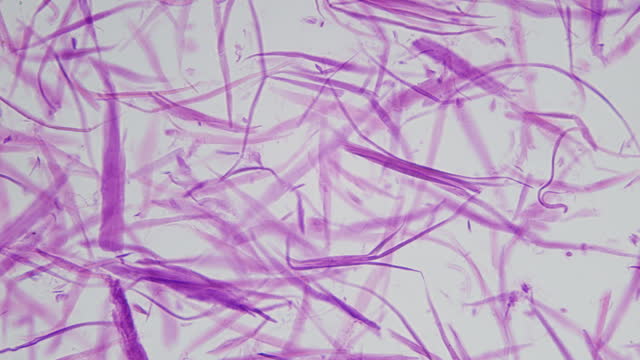 Bundle of human smooth muscle fibers under a microscope an involuntary, non-striated muscle. Smooth muscle consists of thick and thin filaments that are not arranged into sarcomeres giving it a non-striated pattern