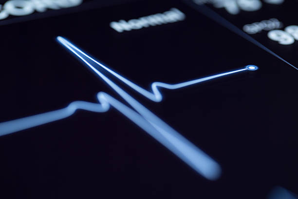 Close up of a heartbeat on a machine stock photo