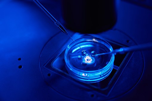 Spermatozoon is being injected into ovum with help of microneedle and holding pipette under microscope