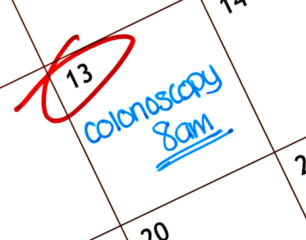 Colonoscopy Appointment Calendar with colonoscopy appointment reminder colorectal cancer photos stock pictures, royalty-free photos & images