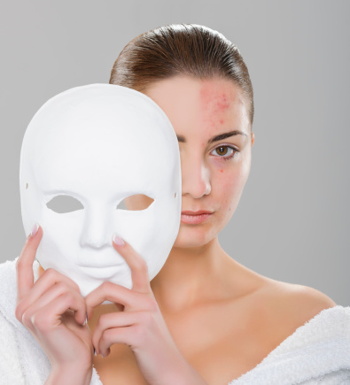 woman with acne on her face holding mask.