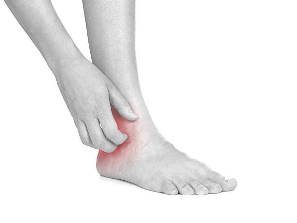 istock Women scratch itchy ankle with hand. 173504423
