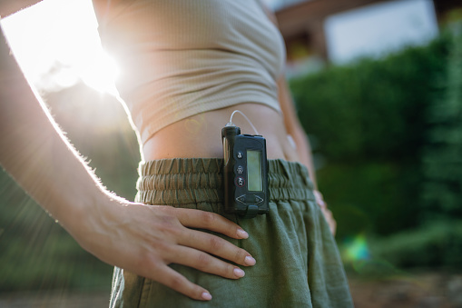 Close up of diabetic woman with insulin pump. Young woman with diabetes outdoors.