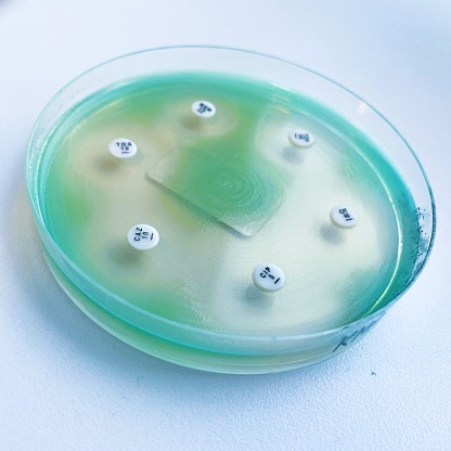 Streptococcus pneumoniae causes acute bacterial infections. Streptococcus pneumonia can be
differentiated from other alpha-hemolytic streptococci
based on its susceptibility to optochin ( the disk is visible on the pic).