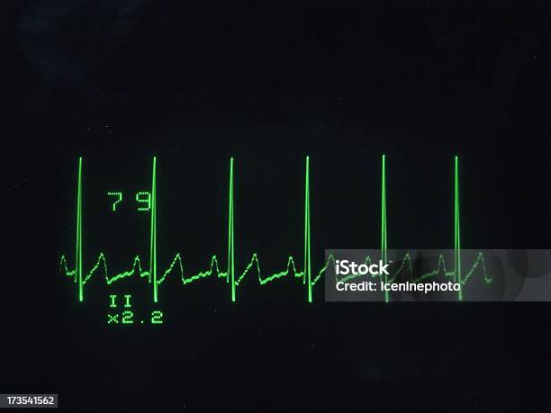 Ecg 波形 - コンセプトのストックフォトや画像を多数ご用意 - コンセプト, データ, ヘルスケアと医療