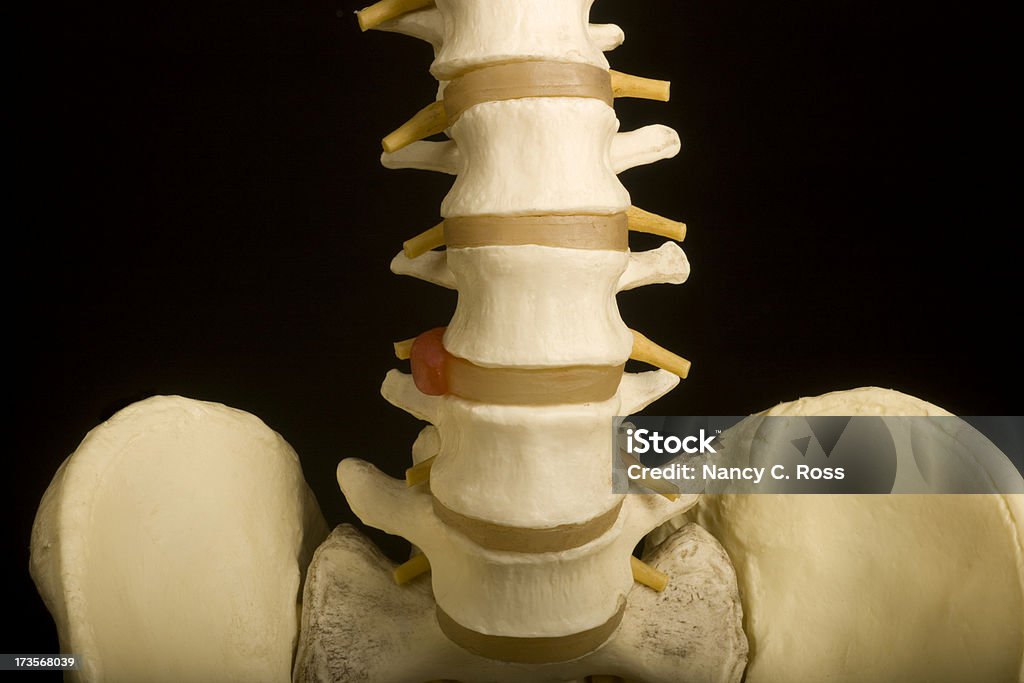 Spina dorsale umana, bacino, medicina, chiropratico, ortopedico, modello medico, sanità, isolato - Foto stock royalty-free di Faccetta articolare