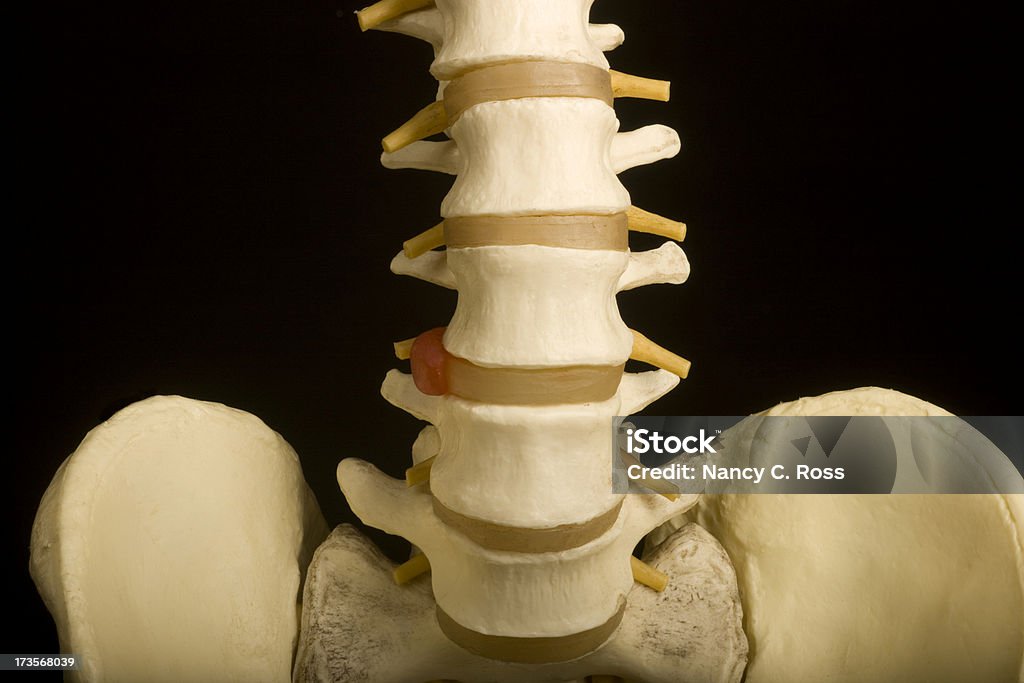휴머니즘 척추, 골반, 의학, 척추교정요법, 정형외과, 의료용 모델, Heathcare, 격리됨에 - 로열티 프리 후관절 스톡 사진