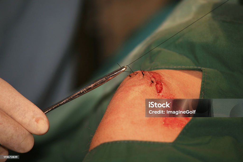 Leg Injury A doctor stitches a leg wound. Blood Stock Photo