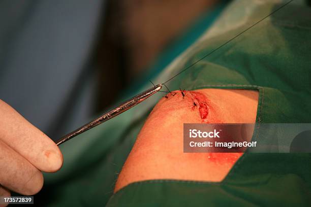 Leg Injury Stock Photo - Download Image Now - Blood, Child, Children Only