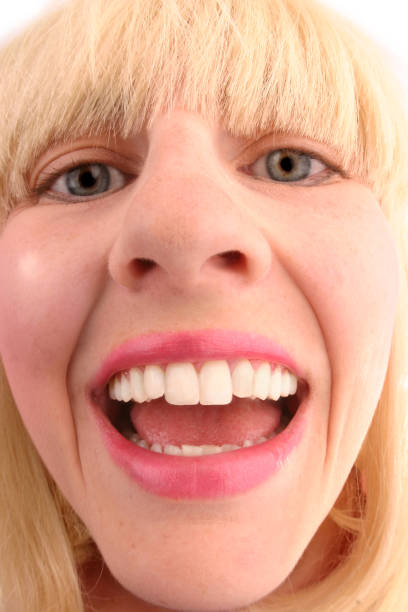 istock Goofy Girl 173614215