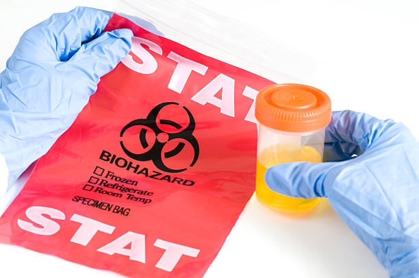 istock Hands Holding Urine Sample and Specimen Bag 173615479