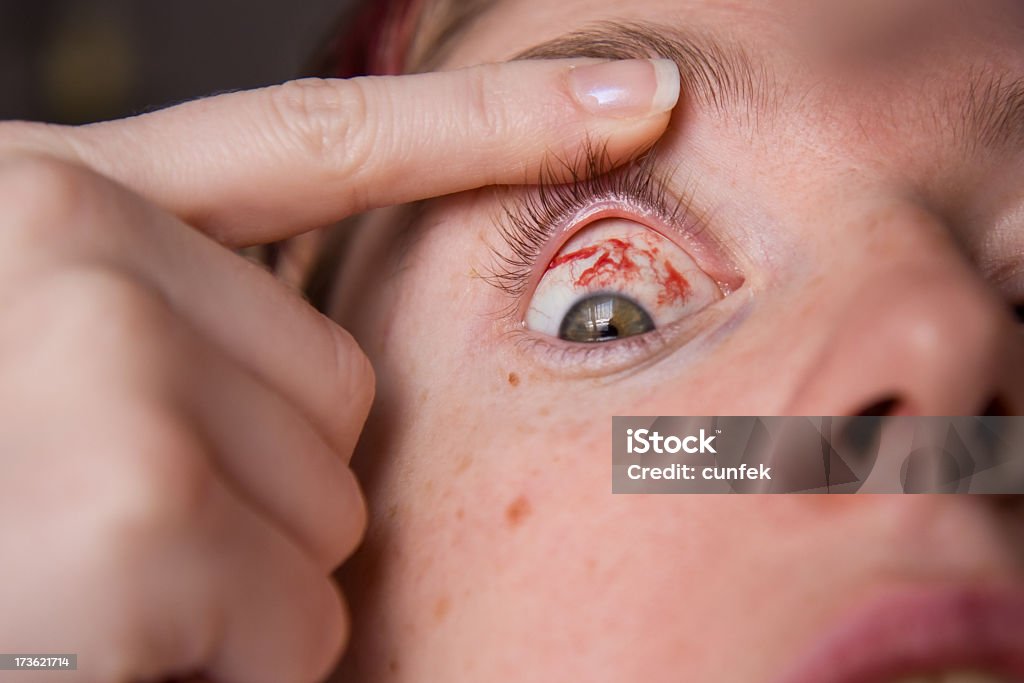 Bloody eye - Foto stock royalty-free di Bellezza