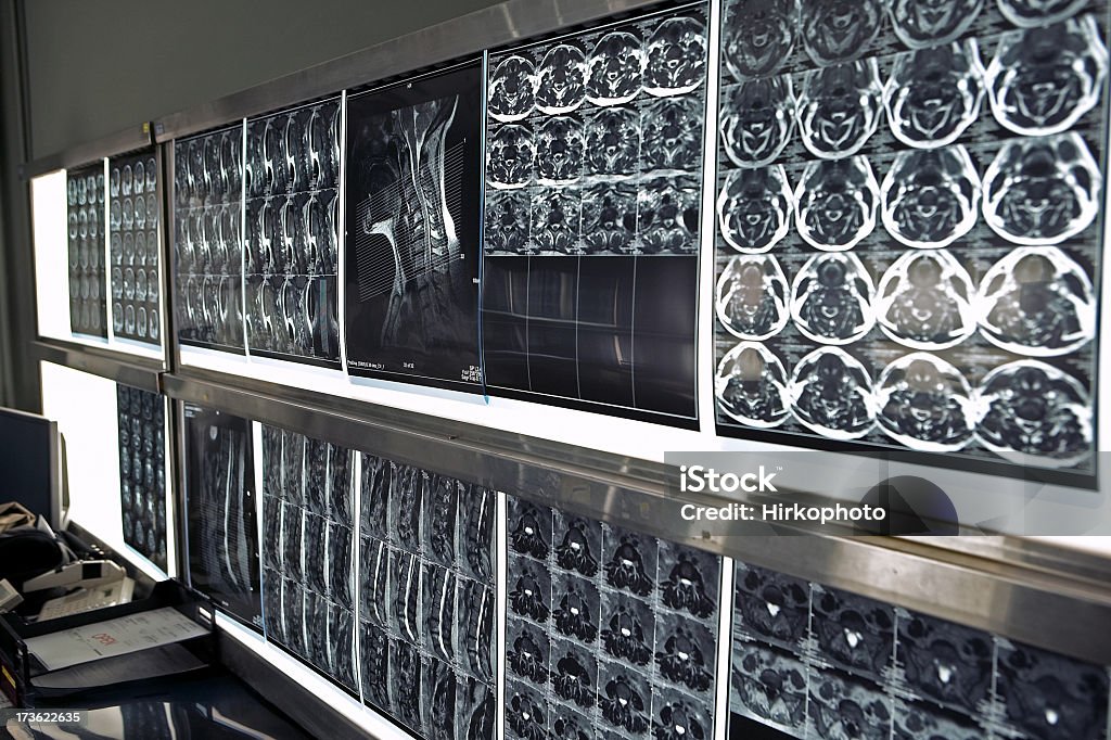 MRI Gehirn-scans Licht-box an der Wand SDOF - Lizenzfrei Anatomie Stock-Foto