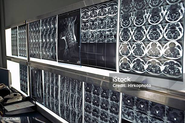 Photo libre de droit de Mri Cerveau Surfe Sur Mur Sdof Light Box banque d'images et plus d'images libres de droit de Aliment en portion - Aliment en portion, Anatomie, Biologie