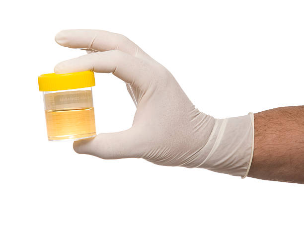 Hand wearing a rubber glove to hold a urine sample A close up of a doctors hand holding a sample jar. urine stock pictures, royalty-free photos & images