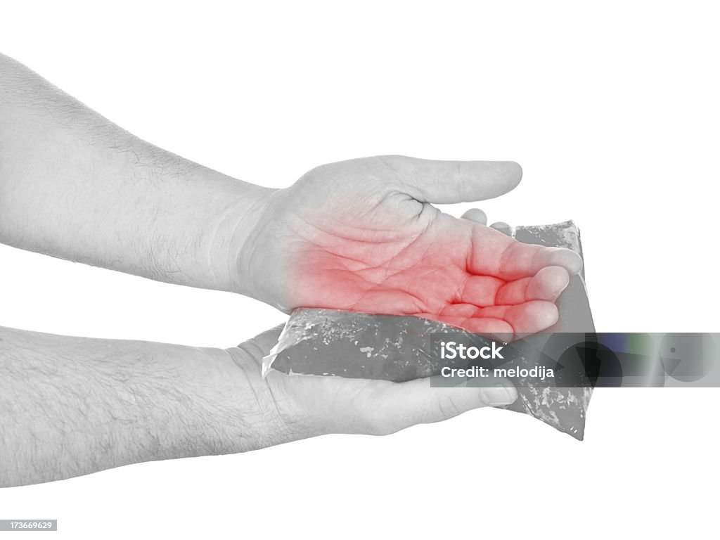 Pacote de gel refrescante em um Inchado hurting palm. - Foto de stock de Adulto royalty-free