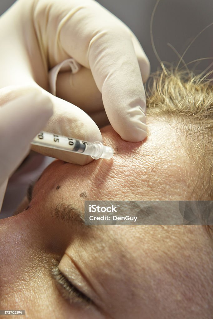 Médico administra Botox tratamento Close-Up - Foto de stock de Adulto royalty-free