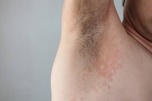 istock Japanese man's armpit with rough skin 1737099860