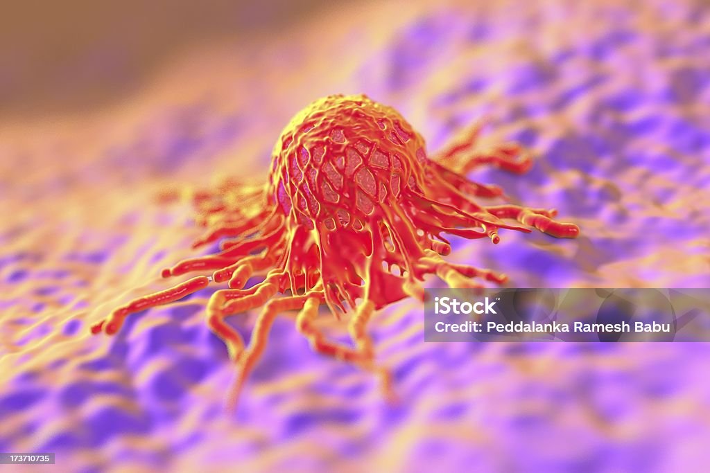 Tumor high detail illustration of cancer cell Abdomen Stock Photo