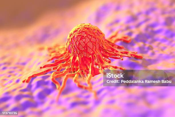 Tumor Stock Photo - Download Image Now - Abdomen, Anatomy, Biological Cell